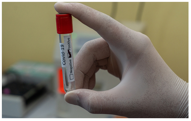 Life-Sciences-Industry-Outlook-amid-COVID-19-Outbreak